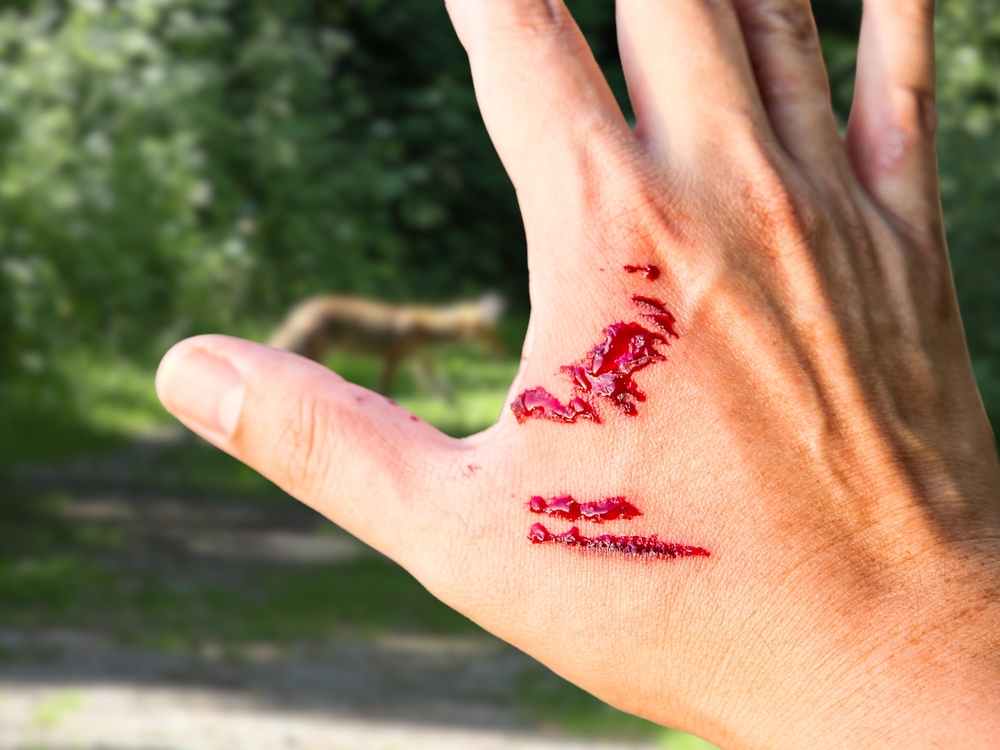 Puncture wounds st augustine